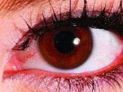 吃瓜会长疮吗,揭秘“吃瓜会长疮”的真相